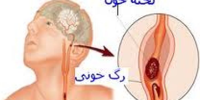 مغز